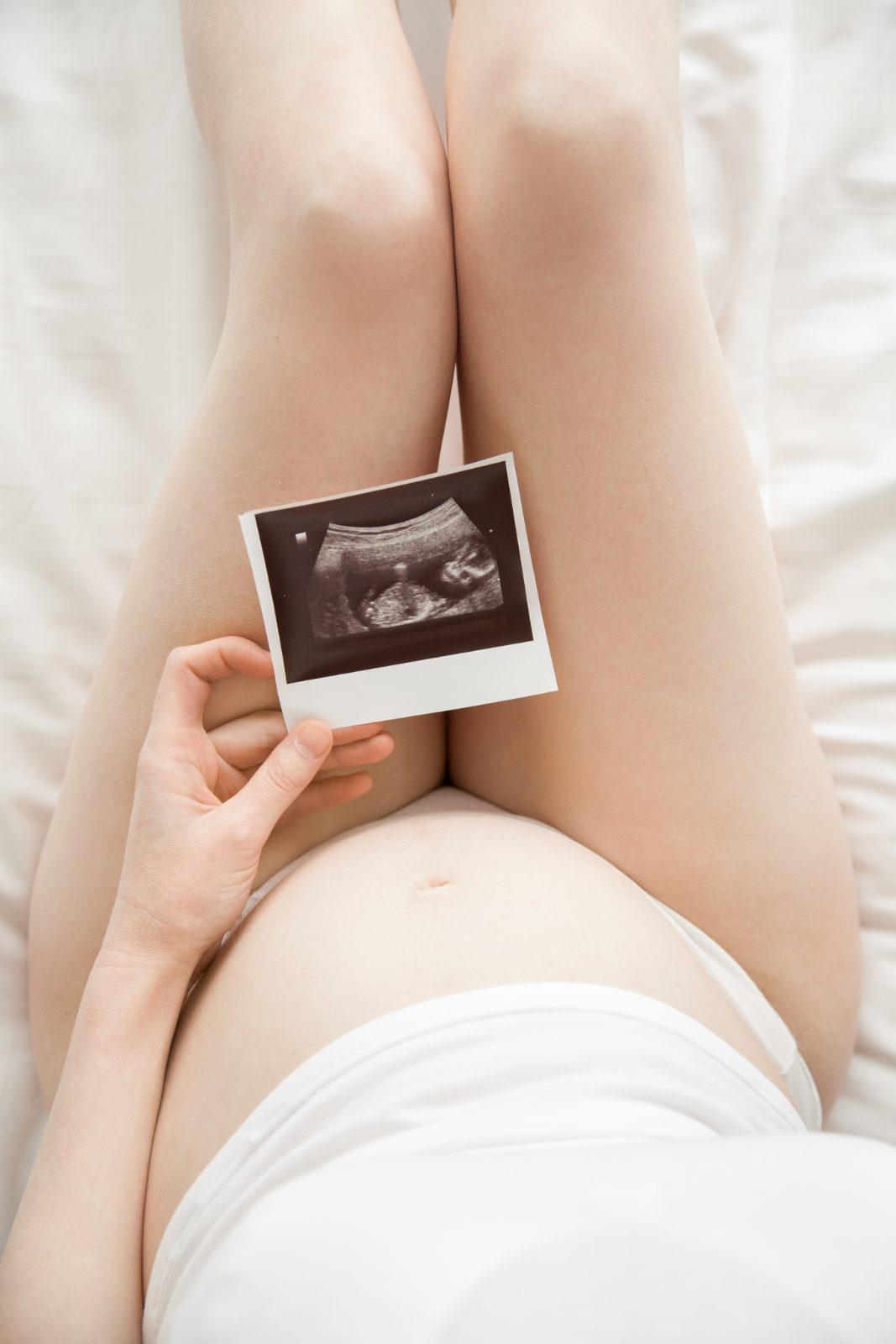 Gestante segura foto do ultrassom sobre a barriga