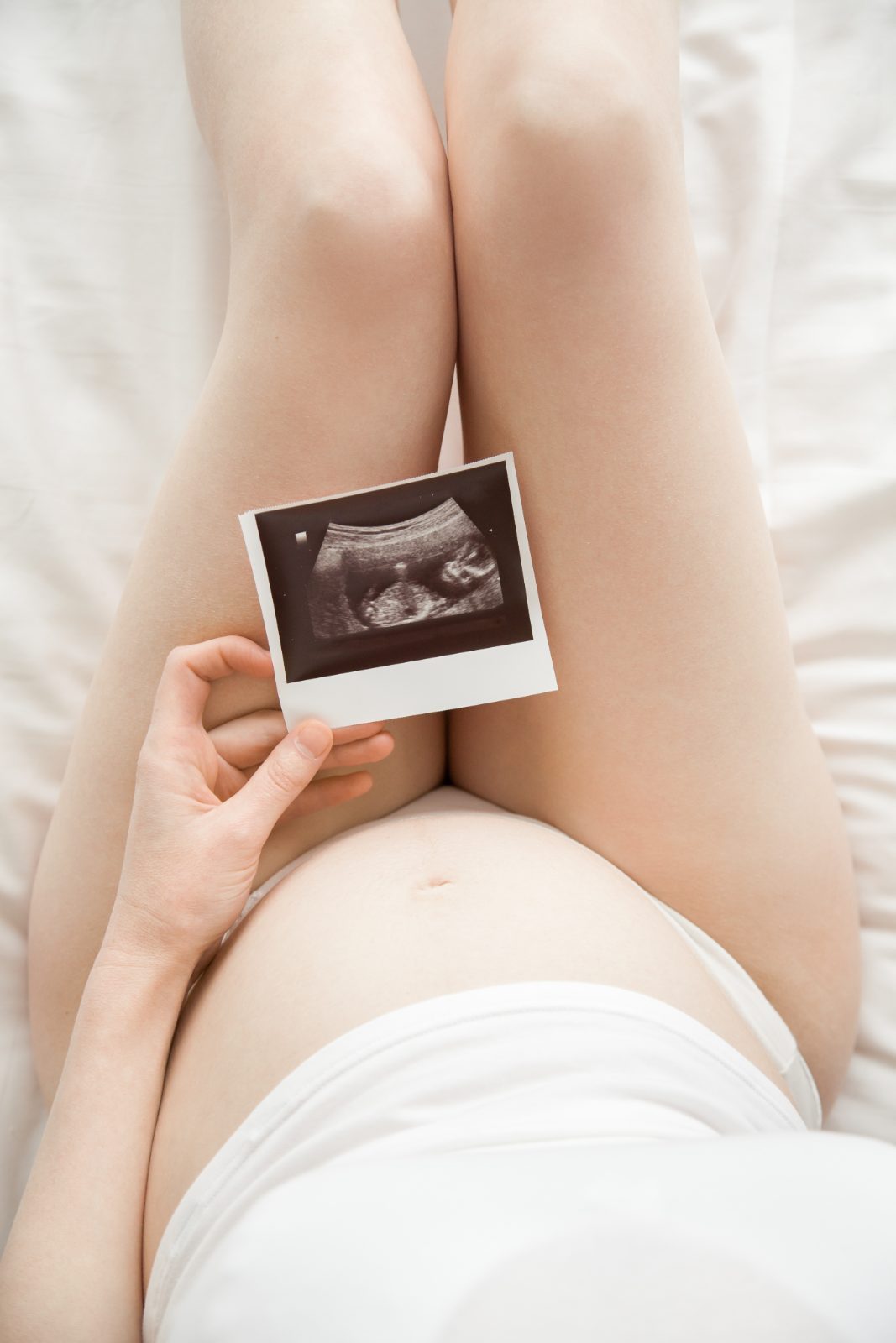 Gestante segura a imagem impressa do ultrassom do bebê