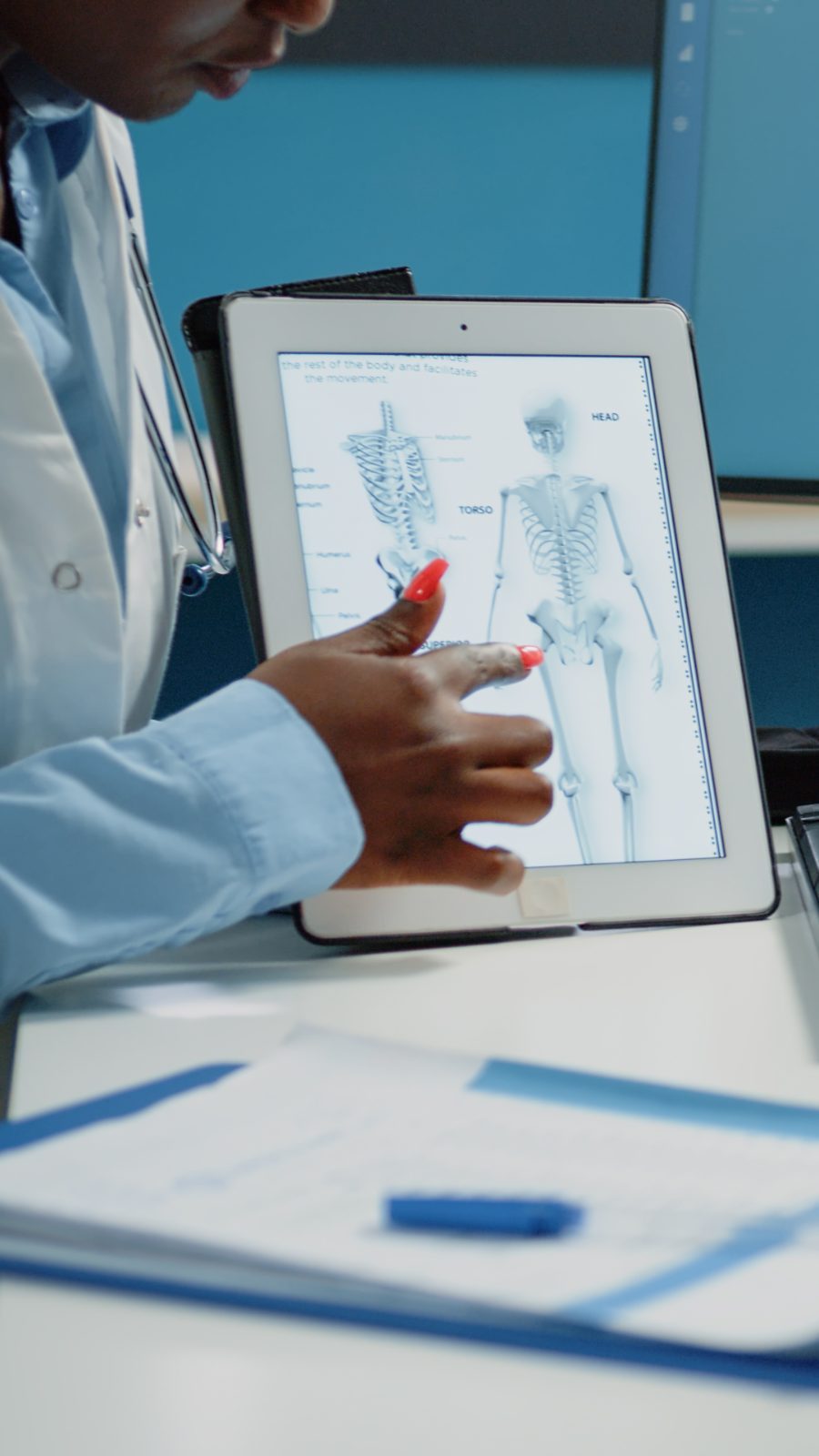 Médico mostra imagem do sistema vascular em um tablet